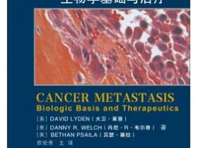肿瘤转移 生物学基础及治疗[Cancer Metastasis Biologic Basis and Therapeutics]pdf